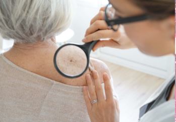 [Odgođeno] PREGLEDI I EDUKACIJE ZA RANO OTKRIVANJE MELANOMA
